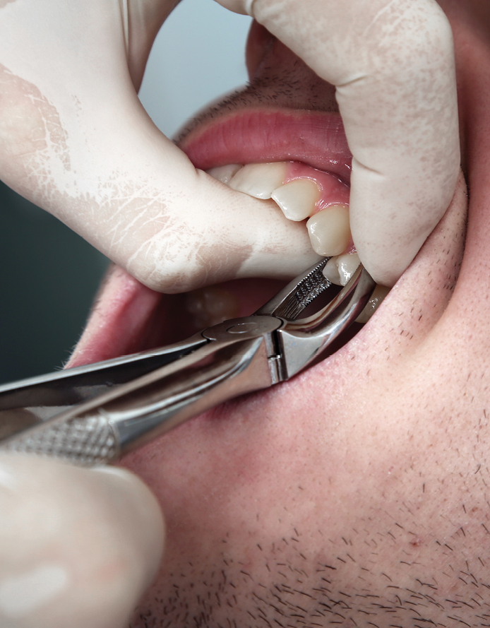 Services Extractions 1